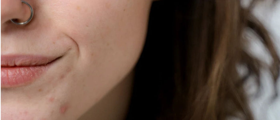 Lower part of the face with spots