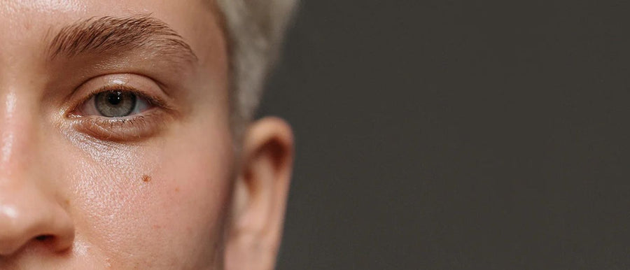 Onzuivere Verzorging