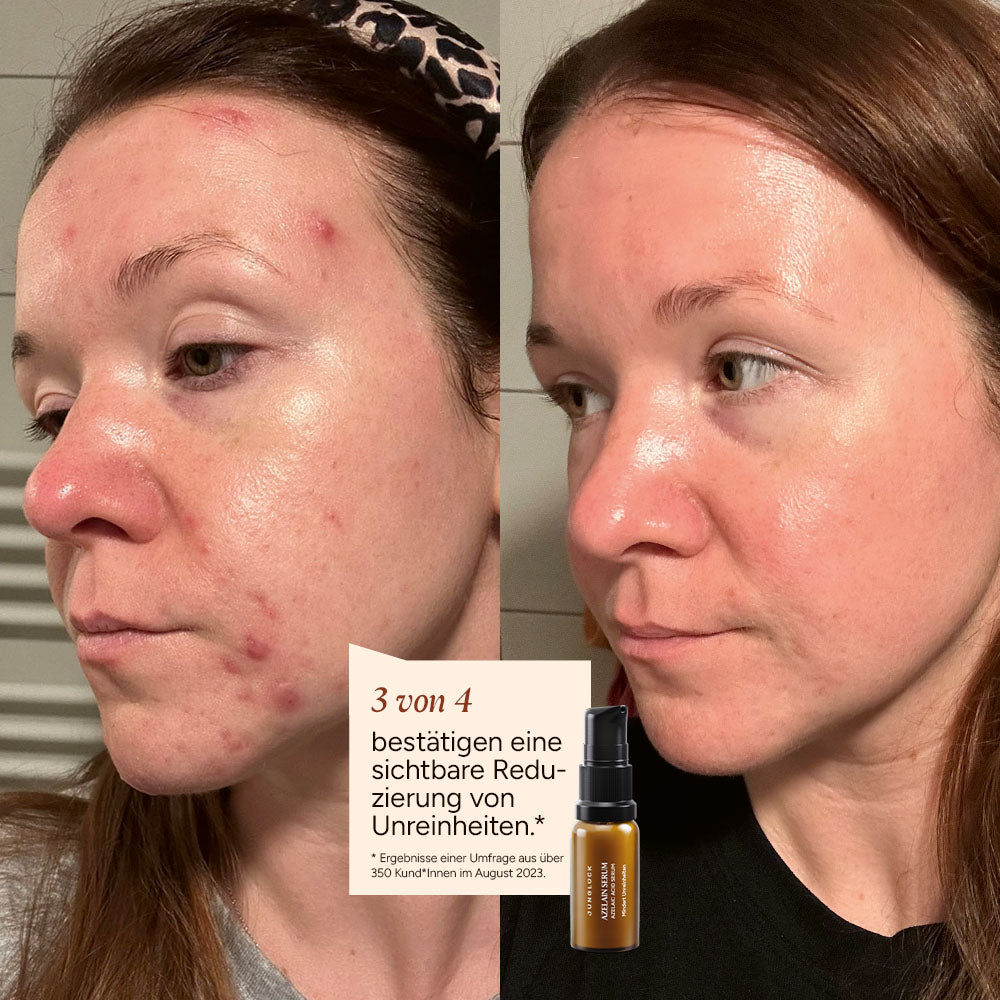 KENNENLERN SET Unreinheiten mindern